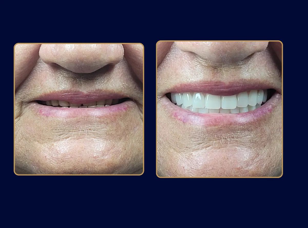 Dra. Grazi Silva - Odontologia em Itatiba em Itatiba, SP